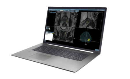 Your match – Transperineal approach or both (Physician) - Site diagnostic